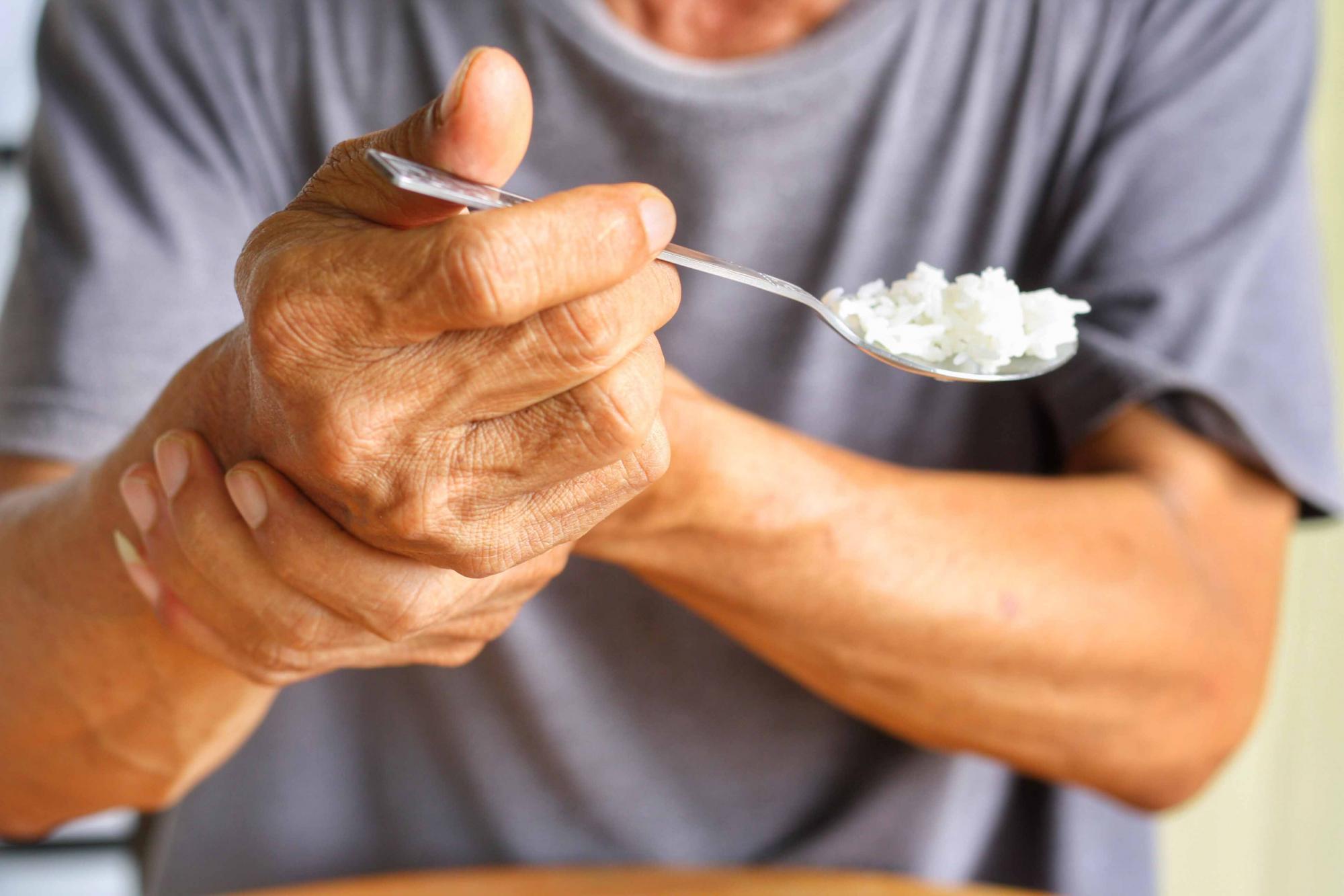 CBD pode ajudar a tratar Mal de Parkinson